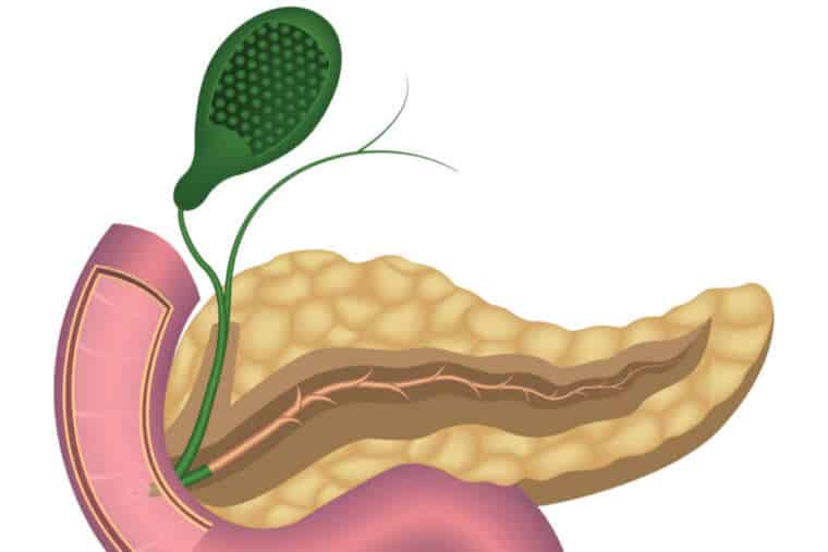 Disfunción del Esfínter de Oddi Qué es y cómo se diagnostica CEGA