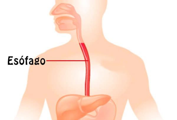 Esófago de Barrett, endoscopia para detectarlo y más