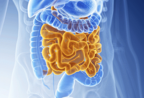 ¿Qué es el síndrome del intestino corto y cómo se trata?