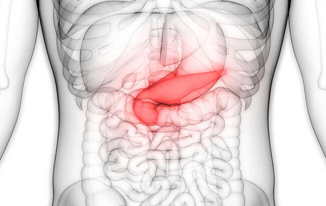 Pancreatitis: Síntomas y Tratamientos