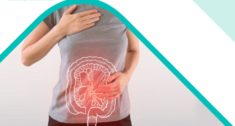 Megacolon Tóxico: Síntomas Y Tratamientos