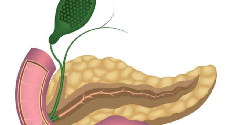 Disfunción del Esfínter de Oddi ¿Qué es y cómo se diagnostica?