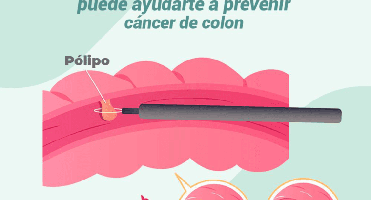 ¿Cómo prevenir el Cáncer de Colon?